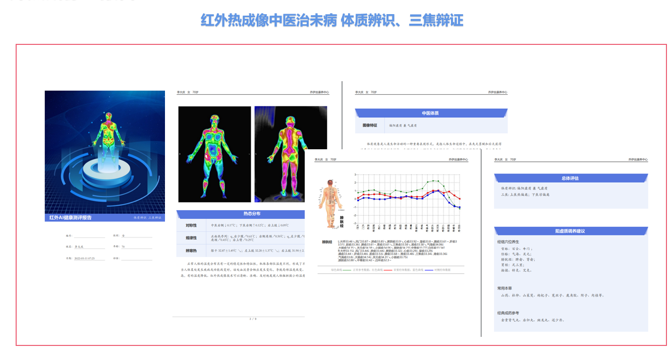 设备示意图